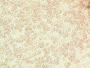 blood_cells_2012-01-19_15-31-45_346_small.jpg